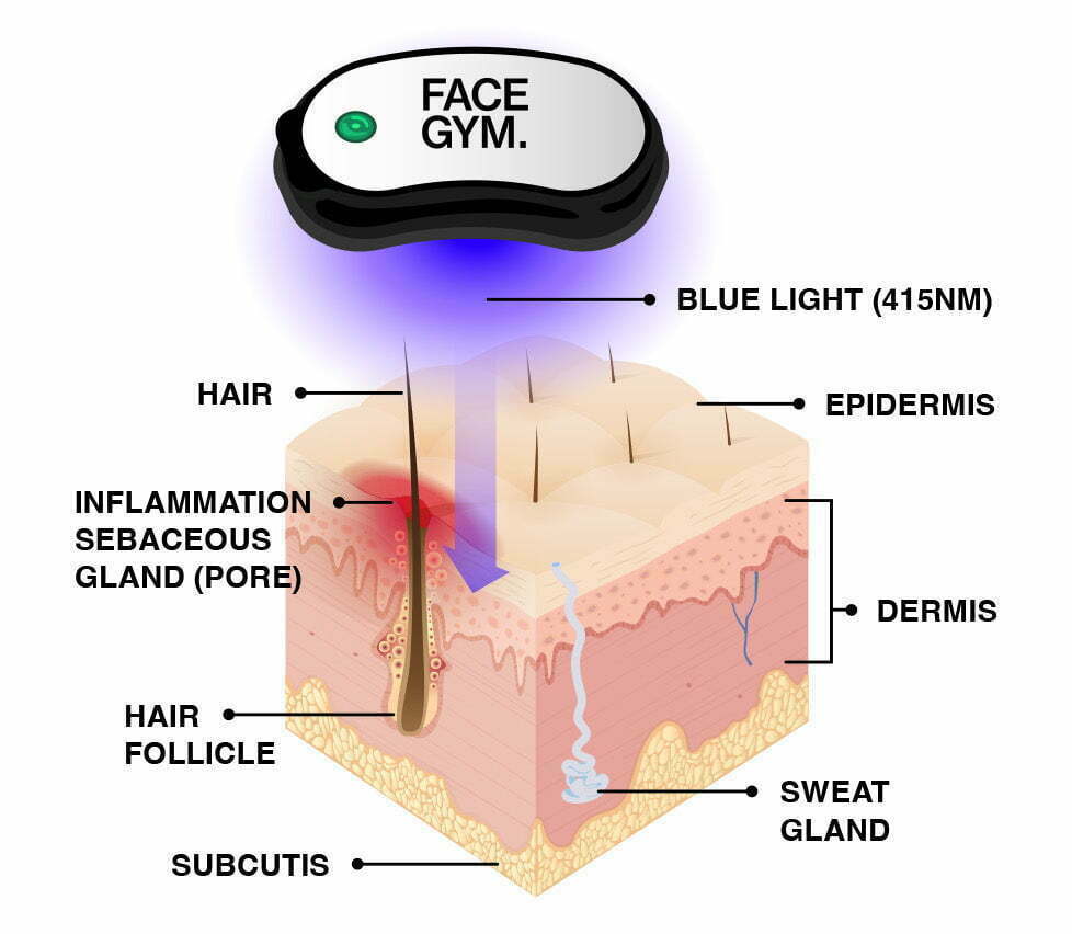FaceGym Acne Light Shot